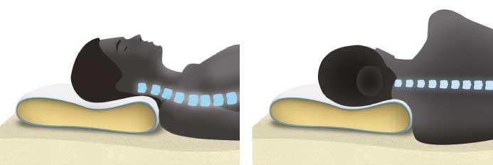 Anatómiai nyakpárna nyakfájásra Anatómiai nyakpárna nyakfájásra